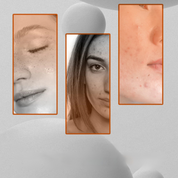 Spotlos Glow Tone - Dark Spot Corrector en Lighlighting of Facial Care-3