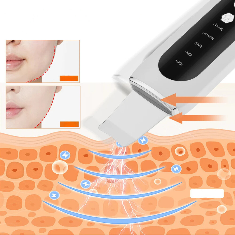 Radiantglow - Face Porne Cleaner en Blackhead Remover-4