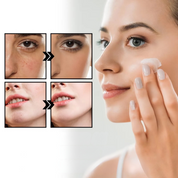 CalmAura Reparationscreme – Til lindring af rosacea og rødme i huden 3