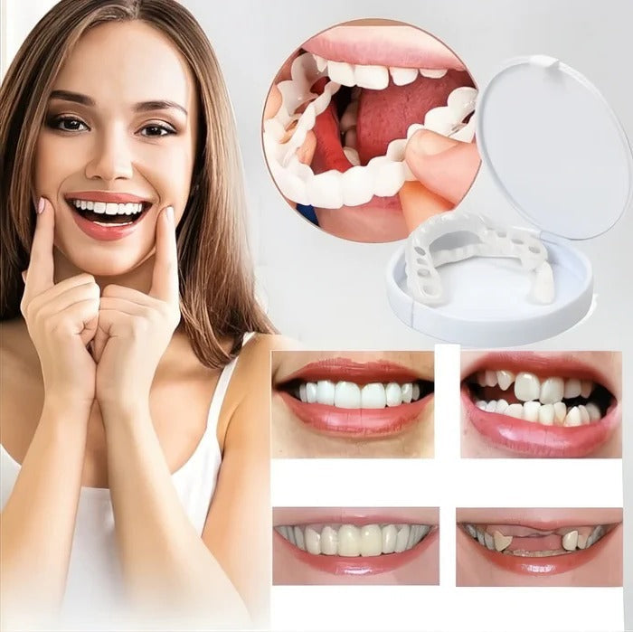 Facader til tænder med naturlig hvid finish 6