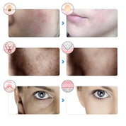 Leeftijd Glow -7 -farben -led -therapie Masker voor gezichtsvermogen en bliksem-5