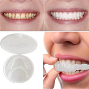 Brightbite - EasyClick -Zahnpothese-3